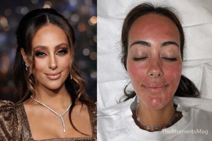 emira d'spain before and after